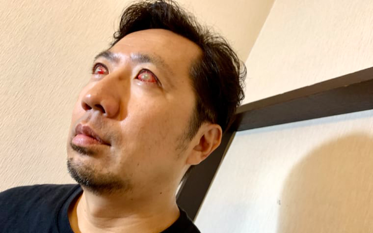子供の頃のケガは一種のアクセサリーだった。大人のゾンビメイクもまた然り
